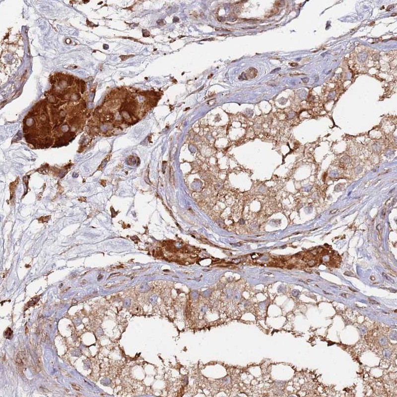 Immunohistochemistry (Formalin/PFA-fixed paraffin-embedded sections) - Anti-C13orf31 antibody (AB254846)
