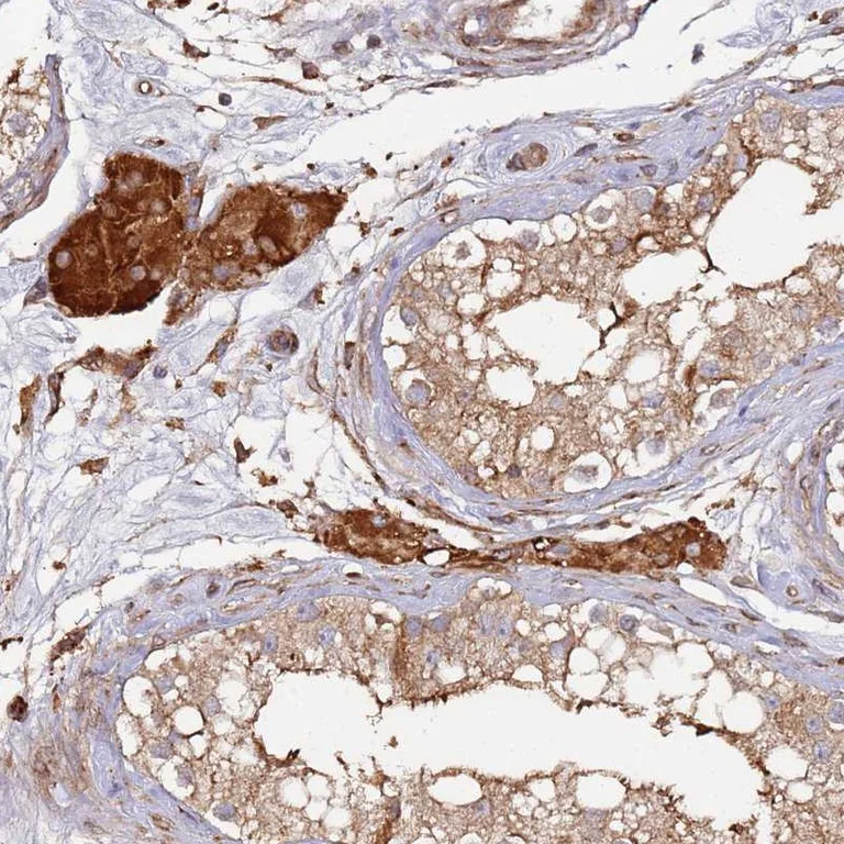 Immunohistochemistry (Formalin/PFA-fixed paraffin-embedded sections) - Anti-C13orf31 antibody (AB254846)