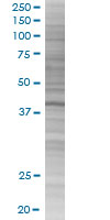 SDS-PAGE - C13orf31 overexpression 293T lysate (whole cell) (AB215389), expandable thumbnail