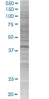 SDS-PAGE - C13orf31 overexpression 293T lysate (whole cell) (AB215389)