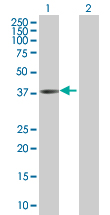 Western blot - C13orf31 overexpression 293T lysate (whole cell) (AB215389), expandable thumbnail