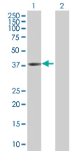 Western blot - C13orf31 overexpression 293T lysate (whole cell) (AB215389)