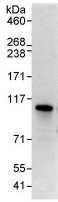 Immunoprecipitation - Anti-C13orf7 antibody (AB91464)