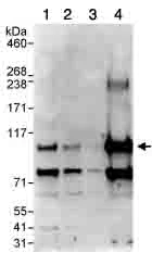 Western blot - Anti-C13orf7 antibody (AB91464)