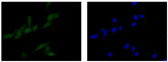Immunocytochemistry/ Immunofluorescence - Anti-C14orf166 antibody [EPR15799] - BSA and Azide free (AB250954)
