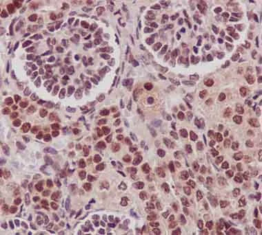 Immunohistochemistry (Formalin/PFA-fixed paraffin-embedded sections) - Anti-C14orf166 antibody [EPR15799] - BSA and Azide free (AB250954)