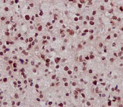 Immunohistochemistry (Formalin/PFA-fixed paraffin-embedded sections) - Anti-C14orf166 antibody [EPR15799] - BSA and Azide free (AB250954)