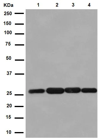 Western blot - Anti-C14orf166 antibody [EPR15799] - BSA and Azide free (AB250954)