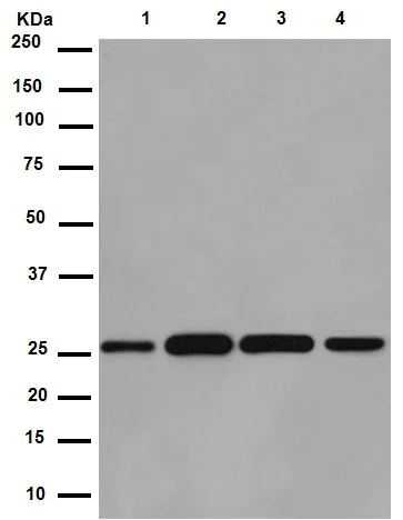 Western blot - Anti-C14orf166 antibody [EPR15799] - BSA and Azide free (AB250954)