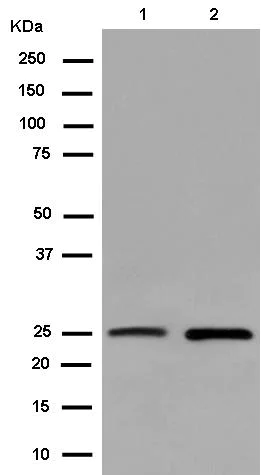 Western blot - Anti-C15orf24 antibody [EPR14097] - BSA and Azide free (AB250621)