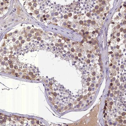 Immunohistochemistry (Formalin/PFA-fixed paraffin-embedded sections) - Anti-C16orf48 antibody (AB224561)