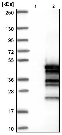Western blot - Anti-C16orf48 antibody (AB224561)