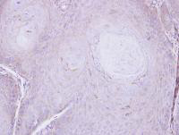 Immunohistochemistry (Formalin/PFA-fixed paraffin-embedded sections) - Anti-C16orf62 antibody (AB97889)