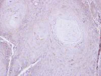 Immunohistochemistry (Formalin/PFA-fixed paraffin-embedded sections) - Anti-C16orf62 antibody (AB97889)
