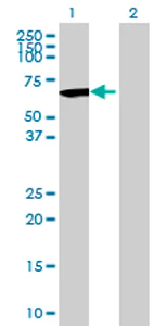 Western blot - Anti-C17orf57 antibody (AB70517)