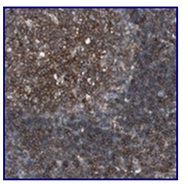 Immunohistochemistry (Formalin/PFA-fixed paraffin-embedded sections) - Anti-C17orf87 antibody (AB121246)