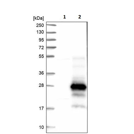 Western blot - Anti-C17orf87 antibody (AB121246)