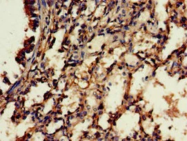 Immunohistochemistry (Formalin/PFA-fixed paraffin-embedded sections) - Anti-C18orf22/RBFA antibody (AB224741)