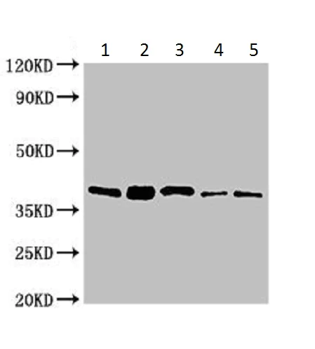 Western blot - Anti-C18orf22/RBFA antibody (AB224741)