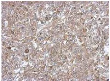 Immunohistochemistry (Formalin/PFA-fixed paraffin-embedded sections) - Anti-C18orf25 antibody (AB151616)