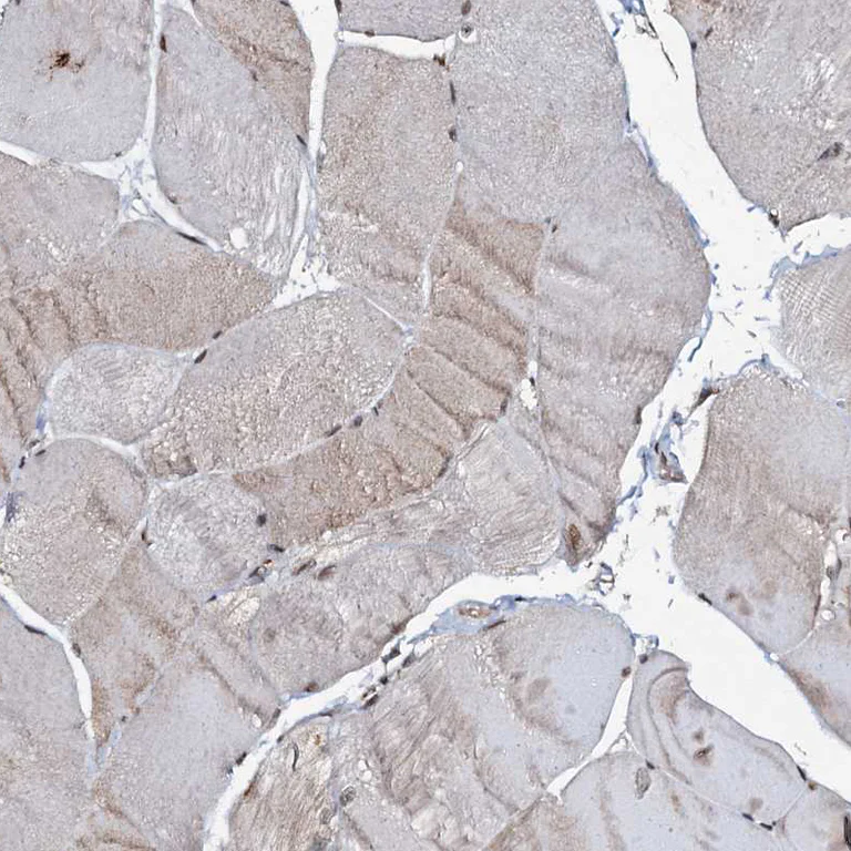 Immunohistochemistry (Formalin/PFA-fixed paraffin-embedded sections) - Anti-C18orf32 antibody (AB122677)