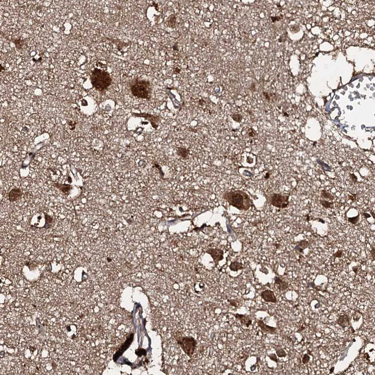 Immunohistochemistry (Formalin/PFA-fixed paraffin-embedded sections) - Anti-C18orf32 antibody (AB122677)