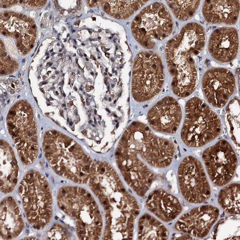 Immunohistochemistry (Formalin/PFA-fixed paraffin-embedded sections) - Anti-C18orf32 antibody (AB122677)
