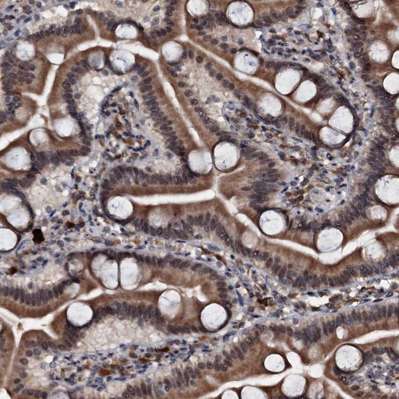 Immunohistochemistry (Formalin/PFA-fixed paraffin-embedded sections) - Anti-C18orf32 antibody (AB122677), expandable thumbnail