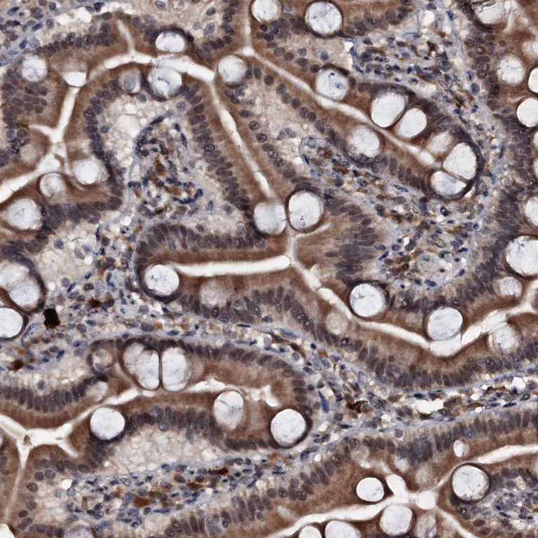 Immunohistochemistry (Formalin/PFA-fixed paraffin-embedded sections) - Anti-C18orf32 antibody (AB122677)