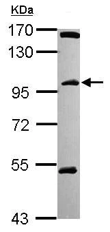 Western blot - Anti-C18orf34 antibody (AB101363)