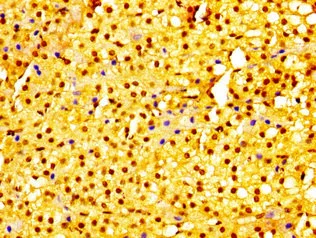 Immunohistochemistry (Formalin/PFA-fixed paraffin-embedded sections) - Anti-C19orf2 antibody (AB235398)