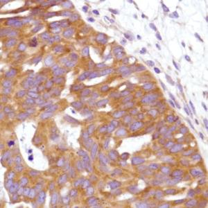 Immunohistochemistry (Formalin/PFA-fixed paraffin-embedded sections) - Anti-C19orf2 antibody [SP215] - C-terminal (AB183310)