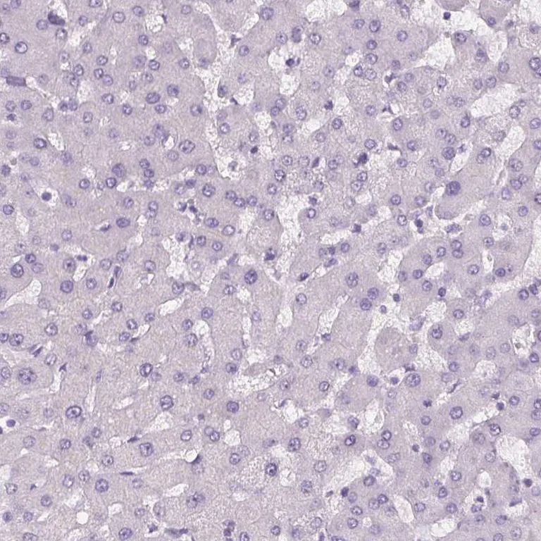 Immunohistochemistry (Formalin/PFA-fixed paraffin-embedded sections) - Anti-C19orf21 antibody (AB254919)
