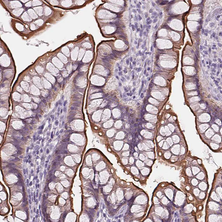 Immunohistochemistry (Formalin/PFA-fixed paraffin-embedded sections) - Anti-C19orf21 antibody (AB254919)