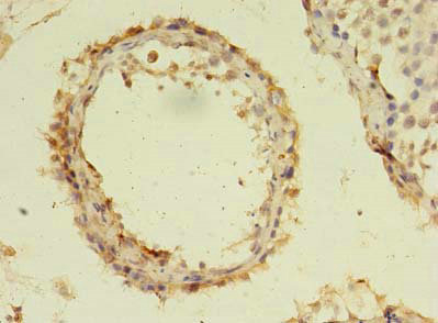 Immunohistochemistry (Formalin/PFA-fixed paraffin-embedded sections) - Anti-C19orf47 antibody (AB236288), expandable thumbnail