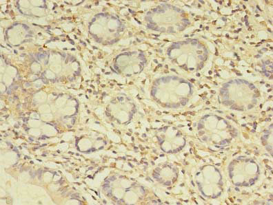 Immunohistochemistry (Formalin/PFA-fixed paraffin-embedded sections) - Anti-C19orf47 antibody (AB236288), expandable thumbnail