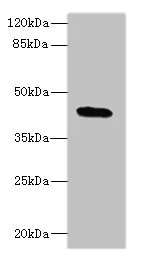 Western blot - Anti-C19orf47 antibody (AB236288)