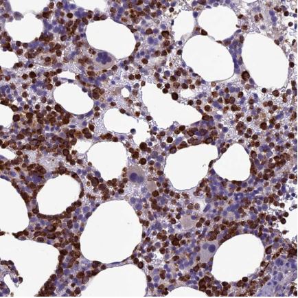 Immunohistochemistry (Formalin/PFA-fixed paraffin-embedded sections) - Anti-C19orf48 antibody (AB122764)