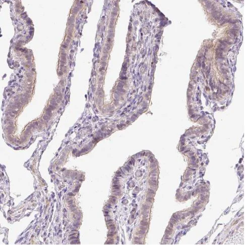 Immunohistochemistry (Formalin/PFA-fixed paraffin-embedded sections) - Anti-C19orf63 antibody (AB185365)