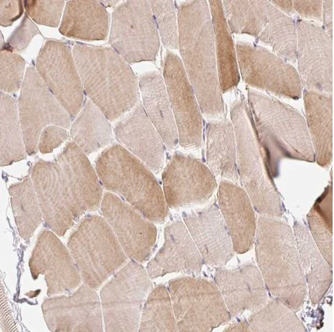 Immunohistochemistry (Formalin/PFA-fixed paraffin-embedded sections) - Anti-C19orf63 antibody (AB185365)