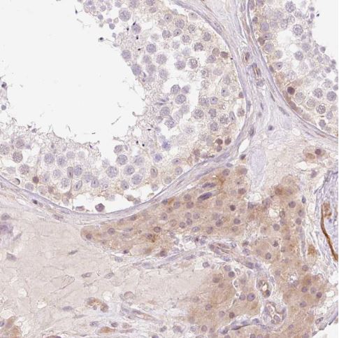 Immunohistochemistry (Formalin/PFA-fixed paraffin-embedded sections) - Anti-C19orf63 antibody (AB185365)