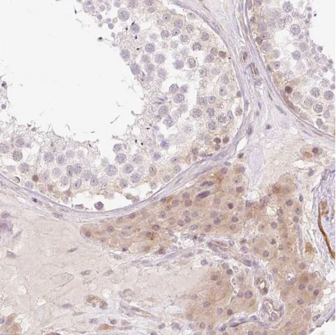Immunohistochemistry (Formalin/PFA-fixed paraffin-embedded sections) - Anti-C19orf63 antibody (AB185365)
