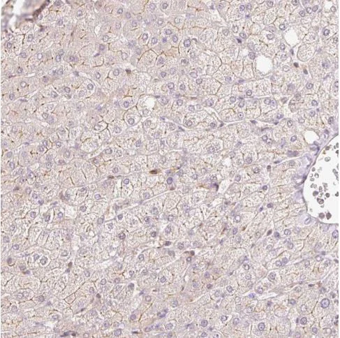 Immunohistochemistry (Formalin/PFA-fixed paraffin-embedded sections) - Anti-C19orf63 antibody (AB185365)