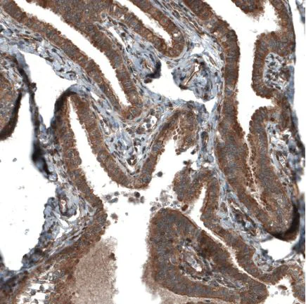Immunohistochemistry (Formalin/PFA-fixed paraffin-embedded sections) - Anti-C19orf66 antibody (AB122765)