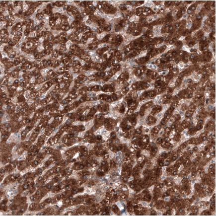 Immunohistochemistry (Formalin/PFA-fixed paraffin-embedded sections) - Anti-C19orf66 antibody (AB122765), expandable thumbnail