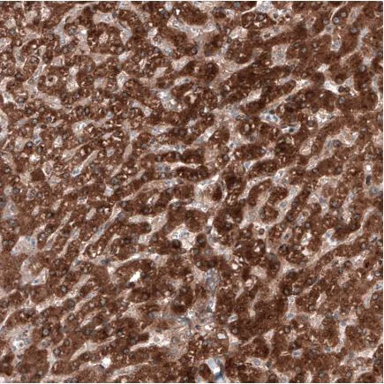 Immunohistochemistry (Formalin/PFA-fixed paraffin-embedded sections) - Anti-C19orf66 antibody (AB122765)