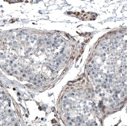 Immunohistochemistry (Formalin/PFA-fixed paraffin-embedded sections) - Anti-C19orf66 antibody (AB122765)