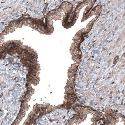 Immunohistochemistry (Formalin/PFA-fixed paraffin-embedded sections) - Anti-C19orf66 antibody (AB122765), expandable thumbnail