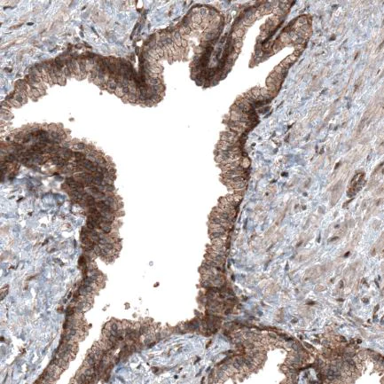 Immunohistochemistry (Formalin/PFA-fixed paraffin-embedded sections) - Anti-C19orf66 antibody (AB122765)