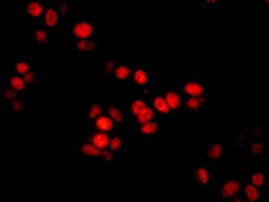Immunocytochemistry/ Immunofluorescence - Anti-C1D antibody [EPR11122] (AB166897), expandable thumbnail